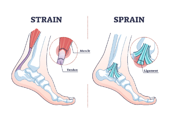 Walk Away From Foot and Ankle Pain This Summer!